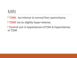 MRI
T1WI: Iso-intense to normal liver parenchyma.
T2WI: Iso to slightly hyper-intense.
Central scar is hypointense inT1WI & hyperintense
in T2WI
 