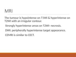 MRI
The tumour is hypointense on T1WI & hyperintense on
T2WI with an irregular contour.
Strongly hyperintense areas on T2WI- necrosis.
DWI: peripherally hyperintense target appearance.
CEMRI is similar to CECT.
 