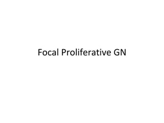 Focal Proliferative GN 