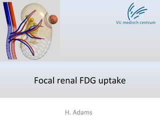 Focal renal FDG uptake
H. Adams
 