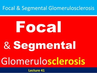 Focal & Segmental Glomerulosclerosis
Focal
& Segmental
Glomerulosclerosis
Lecture 41
 