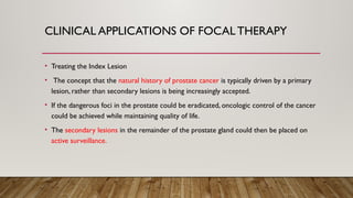 CLINICAL APPLICATIONS OF FOCAL THERAPY
• Treating the Index Lesion
• The concept that the natural history of prostate cancer is typically driven by a primary
lesion, rather than secondary lesions is being increasingly accepted.
• If the dangerous foci in the prostate could be eradicated, oncologic control of the cancer
could be achieved while maintaining quality of life.
• The secondary lesions in the remainder of the prostate gland could then be placed on
active surveillance.
 