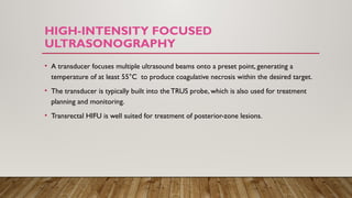 HIGH-INTENSITY FOCUSED
ULTRASONOGRAPHY
• A transducer focuses multiple ultrasound beams onto a preset point, generating a
temperature of at least 55°C to produce coagulative necrosis within the desired target.
• The transducer is typically built into theTRUS probe, which is also used for treatment
planning and monitoring.
• Transrectal HIFU is well suited for treatment of posterior-zone lesions.
 