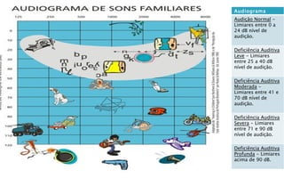 Audiograma
Audição Normal -
Limiares entre 0 a
24 dB nível de
audição.

Deficiência Auditiva
Leve - Limiares
entre 25 a 40 dB
nível de audição.

Deficiência Auditiva
Moderada -
Limiares entre 41 e
70 dB nível de
audição.

Deficiência Auditiva
Severa - Limiares
entre 71 e 90 dB
nível de audição.

Deficiência Auditiva
Profunda - Limiares
acima de 90 dB.
 