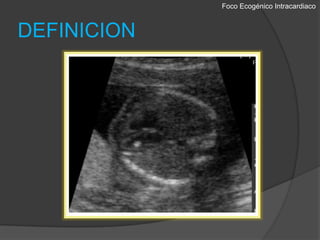 Foco EcogénicoIntracardiacoDEFINICION