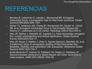 Foco EcogénicoIntracardiacoREFERENCIASBromley B, Lieberman E, Laboda L, Benacerraf BR. Echogenicintracardiacfocus: a sonographicsignfor fetal Down syndrome. ObstetGynecol1995;86(6):998–1001.Winter TC, Anderson AM, Cheng EY, Komarniski CA, Souter VL, Uhrich SB, et al. Echogenicintracardiacfocus in 2nd-trimester fetuseswithtrisomy21: usefulness as a US marker. Radiology 2000;216(2):450–6.Wax JR, Mather J, Steinfeld JD, Ingardia CJ. Fetal intracardiacechogenicfoci: current understanding and clinical significance. ObstetGynecolSurvey 2000;55(3):303–11.Wax JR, Royer D, Mather J, Chen C, Aponte-Garcia A, Steinfeld JD, et al. A preliminary study of sonographic grading of fetal intracardiac foci: feasibility, reliability, and association with aneuploidy. Ultrasound ObstetGynecol2000;16(2):123–7.Smith-Bindman R, Hosmer W, Feldstein VA, Deeks JJ, Goldberg JD. Second-trimester ultrasound to detect fetuses with Down syndrome–a meta-analysis. JAMA 2001;285(8):1044–55.
