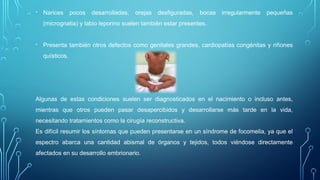 Focomelia Rx Estimulación temprana infantil Focomelia - Discapacidad motora | PPTX
