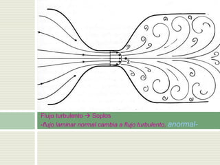 Flujo turbulento  Soplos
-flujo laminar normal cambia a flujo turbulento, anormal-
 