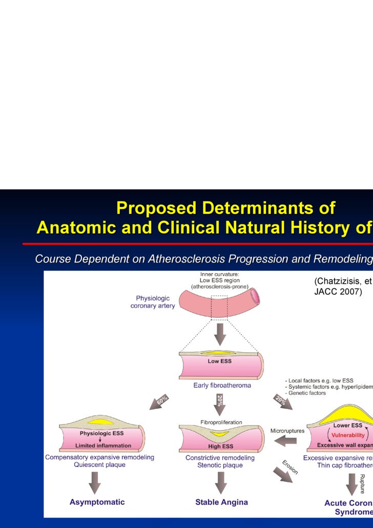 Natural History Of Atherosclerosis Natural History Of Atherosclerosis
