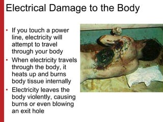 Electrical Damage to the Body <ul><li>If you touch a power line, electricity will attempt to travel through your body </li...