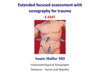 Samir Haffar MD
Gastroenterologist & Sonographer
Damascus – Syrian Arab Republic
Extended focused assessment with
sonography for trauma
E-FAST
 