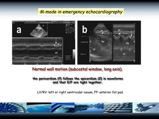 focused-echocardiographic-evaluation-in-resuscitation-management425.ppt