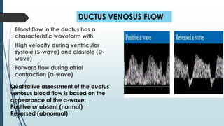 DUCTUS VENOSUS FLOW
Blood flow in the ductus has a
characteristic waveform with:
High velocity during ventricular
systole (S-wave) and diastole (D-
wave)
Forward flow during atrial
contraction (a-wave)
Qualitative assessment of the ductus
venosus blood flow is based on the
appearance of the a-wave:
Positive or absent (normal)
Reversed (abnormal)
 