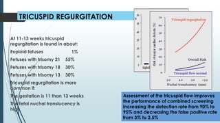 TRICUSPID REGURGITATION
At 11-13 weeks tricuspid
regurgitation is found in about:
Euploid fetuses 1%
Fetuses with trisomy 21 55%
Fetuses with trisomy 18 30%
Fetuses with trisomy 13 30%
Tricuspid regurgitation is more
common if:
The gestation is 11 than 13 weeks
The fetal nuchal translucency is
high
Assessment of the tricuspid flow improves
the performance of combined screening
increasing the detection rate from 90% to
95% and decreasing the false positive rate
from 3% to 2.5%
 