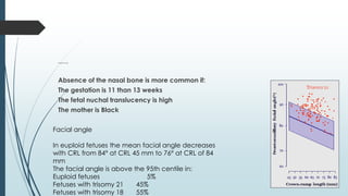 Nasal bone
Absence of the nasal bone is more common if:
The gestation is 11 than 13 weeks
The fetal nuchal translucency is high
The mother is Black
Facial angle
In euploid fetuses the mean facial angle decreases
with CRL from 84° at CRL 45 mm to 76° at CRL of 84
mm
The facial angle is above the 95th centile in:
Euploid fetuses 5%
Fetuses with trisomy 21 45%
Fetuses with trisomy 18 55%
 