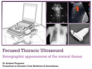 +

Focused Thoracic Ultrasound
Sonographic appearances of the normal thorax
Dr Andrew Ferguson
Consultant in Intensive Care Medicine & Anaesthesia

 