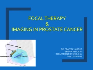 FOCALTHERAPY
&
IMAGING IN PROSTATE CANCER
DR. PRATEEK LADDHA
SENIOR RESIDENT
DEPARTMENT OF UROLOGY
CMC LUDHIANA
 