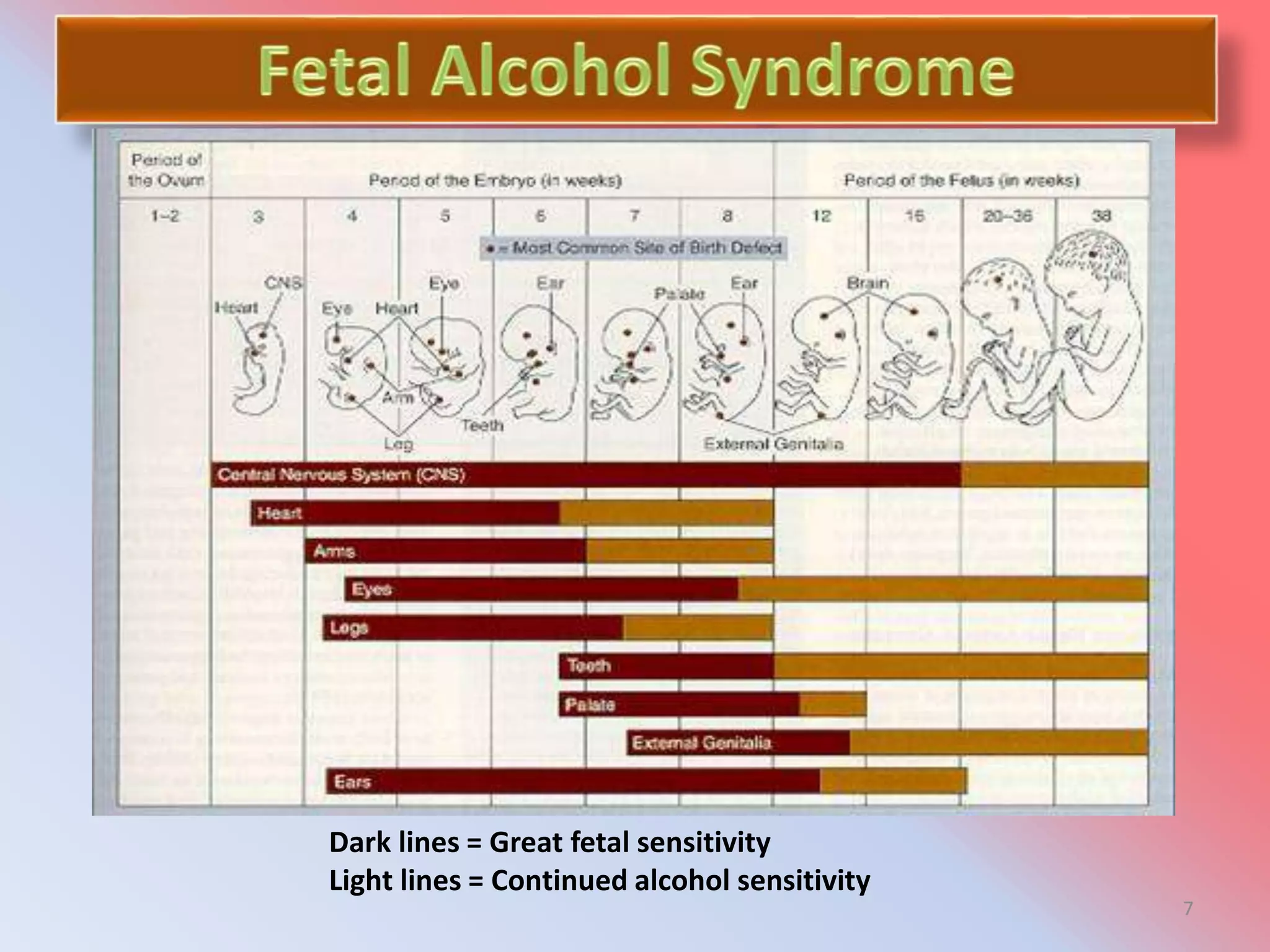 Foetal alcohol syndrome short talk PPT