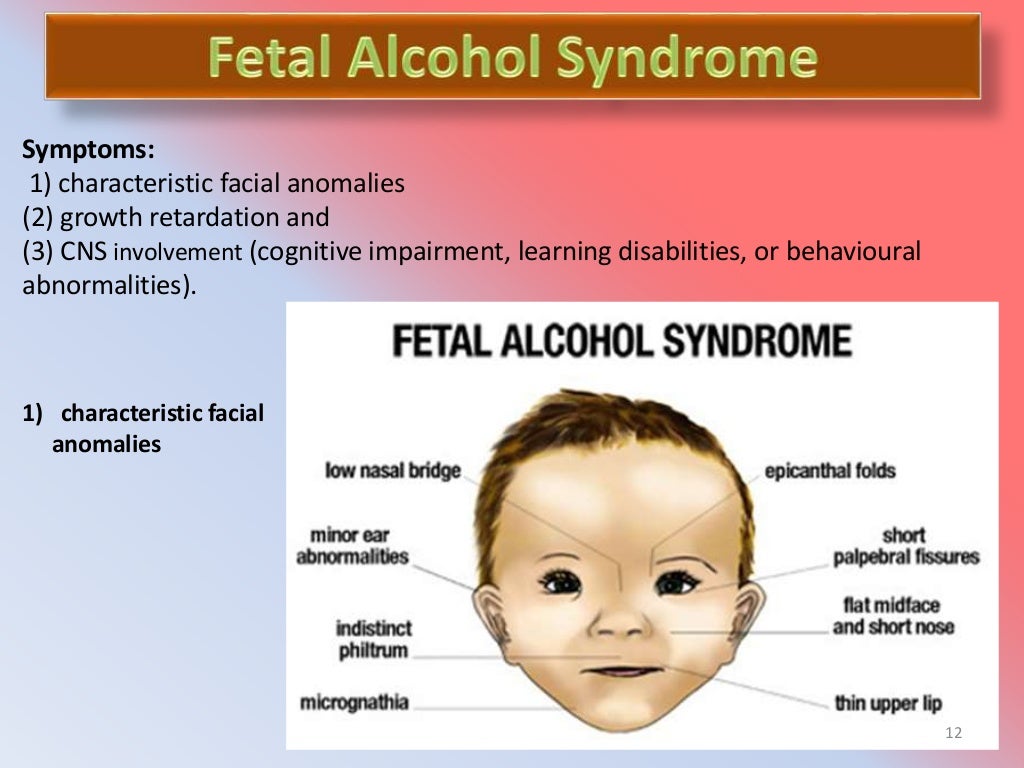 Foetal alcohol syndrome short talk