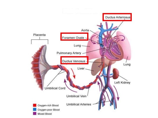 Persistent pulmonary hypertension of the newborn