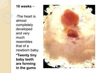 10 weeks –
•The heart is
almost
completely
developed
and very
much
resembles
that of a
newborn baby.
*Twenty tiny
baby teeth
are forming
in the gums
 