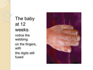 The baby
at 12
weeks:
notice the
webbing
on the fingers,
with
the digits still
fused
 