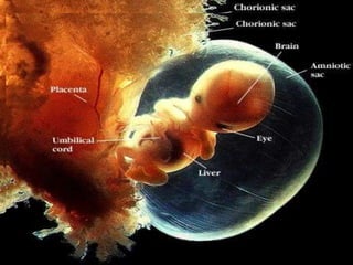 Two Months
Two Months
 