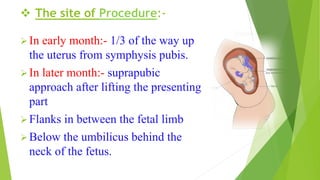  The site of Procedure:-
In early month:- 1/3 of the way up
the uterus from symphysis pubis.
In later month:- suprapubic
approach after lifting the presenting
part
Flanks in between the fetal limb
Below the umbilicus behind the
neck of the fetus.
 