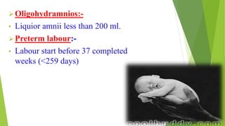 Oligohydramnios:-
• Liquior amnii less than 200 ml.
Preterm labour:-
• Labour start before 37 completed
weeks (<259 days)
 