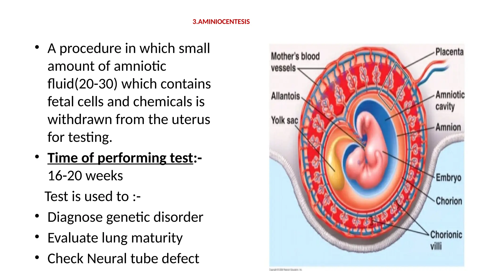 3.AMINIOCENTESIS
• A procedure in which small
amount of amniotic
fluid(20-30) which contains
fetal cells and chemicals is
withdrawn from the uterus
for testing.
• Time of performing test:-
16-20 weeks
Test is used to :-
• Diagnose genetic disorder
• Evaluate lung maturity
• Check Neural tube defect
 
