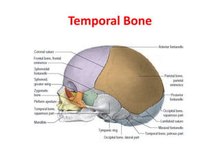 Temporal Bone
 