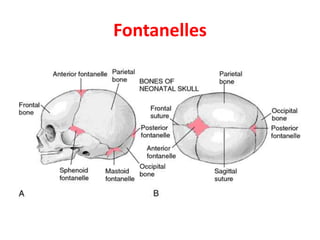 Fontanelles
 
