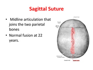 Sagittal Suture
• Midline articulation that
joins the two parietal
bones
• Normal fusion at 22
years.
 