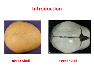 Introduction
Adult Skull Fetal Skull
 