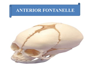 ANTERIOR FONTANELLE
 
