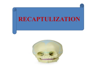 RECAPTULIZATION
 
