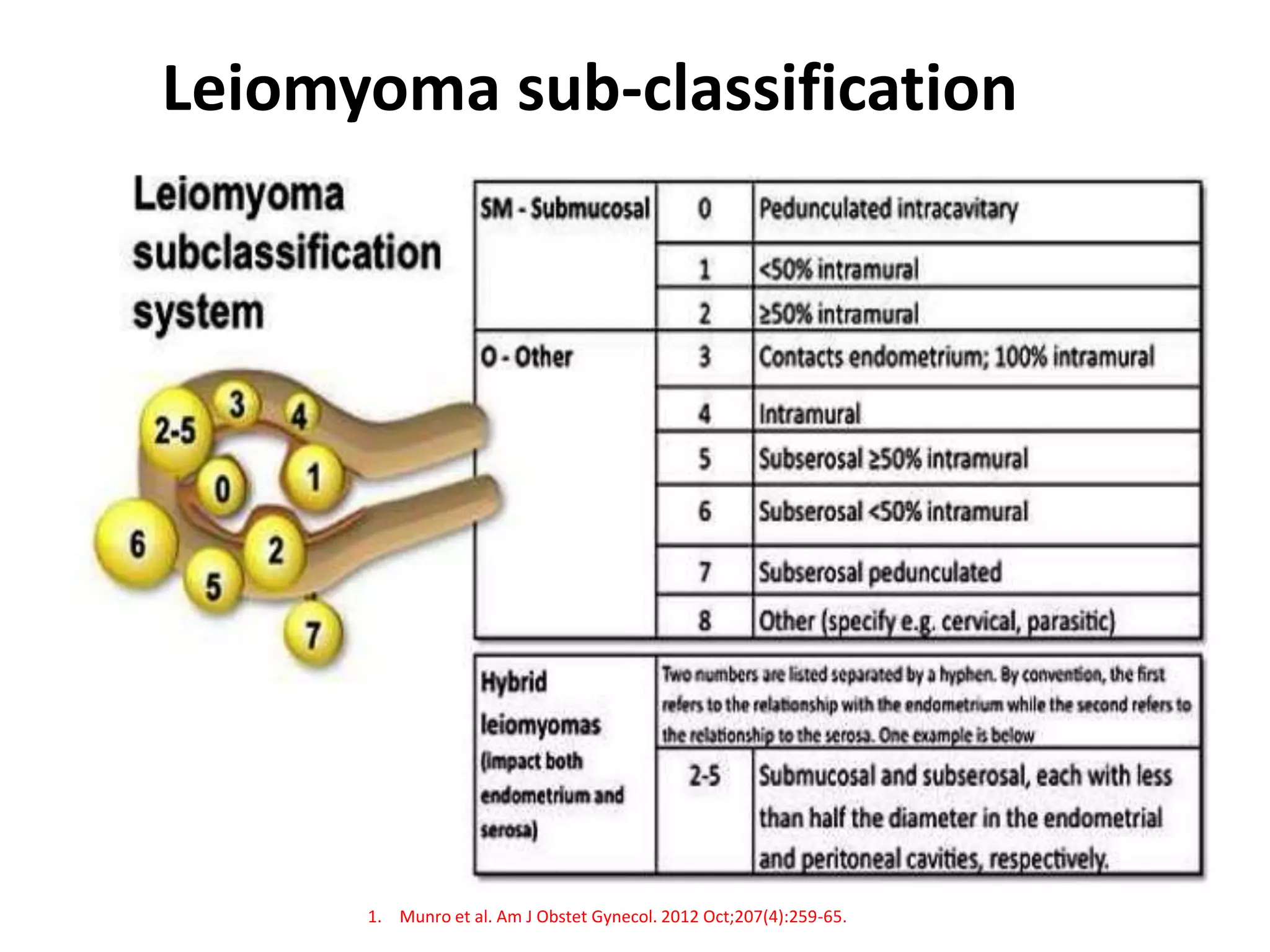 Leiomyoma sub-classification
1. Munro et al. Am J Obstet Gynecol. 2012 Oct;207(4):259-65.
 