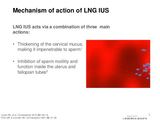 Levonorgestrel Intrauterine System (Ius)