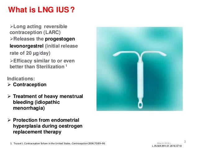 Levonorgestrel Intrauterine System (Ius)
