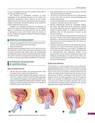 FOGSI FOCUS Surgical Skills in Obstetrics and Gynecology | PDF