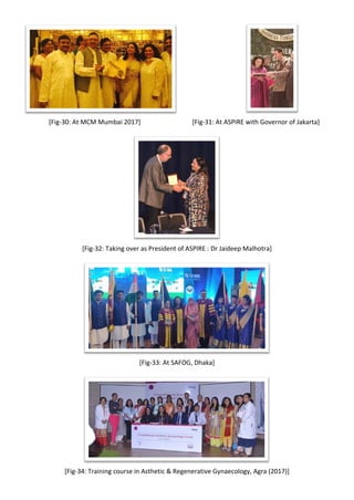 [Fig-30: At MCM Mumbai 2017] [Fig-31: At ASPIRE with Governor of Jakarta]
[Fig-32: Taking over as President of ASPIRE : Dr Jaideep Malhotra]
[Fig-33: At SAFOG, Dhaka]
[Fig-34: Training course in Asthetic & Regenerative Gynaecology, Agra (2017)]
 