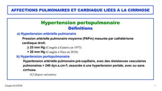Claude EUGÈNE
AFFECTIONS PULMONAIRES ET CARDIAQUE LIÉES À LA CIRRHOSE
Hypertension portopulmonaire


Définitions


a) Hype...