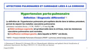 Claude EUGÈNE
AFFECTIONS PULMONAIRES ET CARDIAQUE LIÉES À LA CIRRHOSE
Hypertension porto-pulmonaire


Définition / Diagnos...