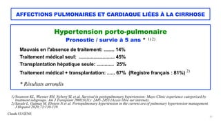 Claude EUGÈNE
AFFECTIONS PULMONAIRES ET CARDIAQUE LIÉES À LA CIRRHOSE
Hypertension porto-pulmonaire


Pronostic / survie à...