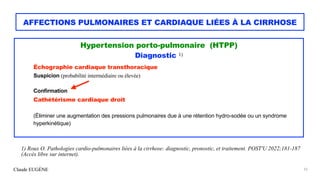 Claude EUGÈNE
AFFECTIONS PULMONAIRES ET CARDIAQUE LIÉES À LA CIRRHOSE
Hypertension porto-pulmonaire (HTPP)


Diagnostic 1)...
