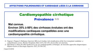 Claude EUGÈNE
AFFECTIONS PULMONAIRES ET CARDIAQUE LIÉES À LA CIRRHOSE
Cardiomyopathie cirrhotique


Prévalence 1) 2)


Mal...