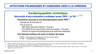 Claude EUGÈNE
AFFECTIONS PULMONAIRES ET CARDIAQUE LIÉES À LA CIRRHOSE
Cardiomyopathie cirrhotique


 
Nécessité d'une éval...