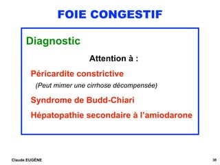 FOIE CONGESTIF
Diagnostic
Attention à :
Péricardite constrictive 
(Peut mimer une cirrhose décompensée)
Syndrome de Budd-C...