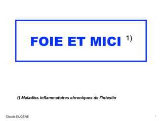 FOIE ET MICI 1)
1) Maladies inflammatoires chroniques de l'intestin
Claude EUGÈNE 1
 