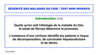 Claude EUGÈNE
SÉVÉRITÉ DES MALADIES DU FOIE / TEST NON INVASIFS
Introduction (1/4)


Quelle qu'en soit l'étiologie de la maladie du foie,


le stade de fibrose détermine le pronostic.


L'existence d'une cirrhose identifie les patients à risque


de décompensation, de carcinome hépatocellulaire


et de décès.
4
 